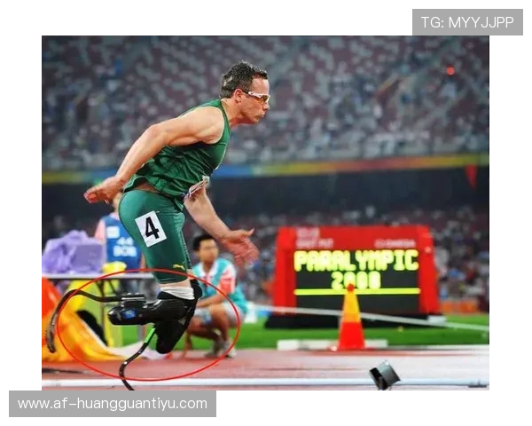 奥斯卡·皮斯托瑞斯咋还穿得比我闺女时髦，这腿是真的能打篮球吗？